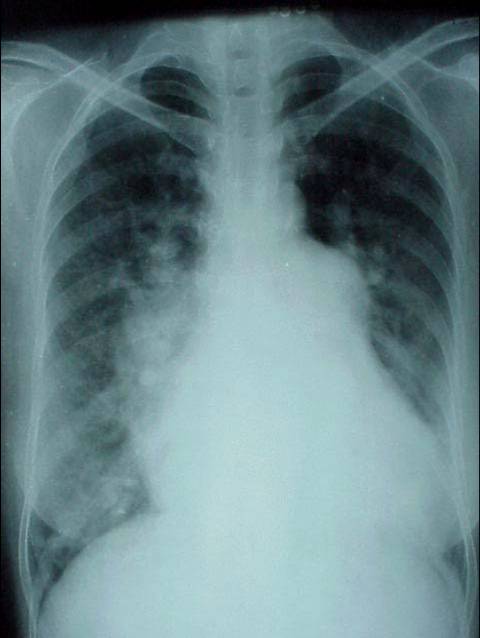 100张典型X线图片