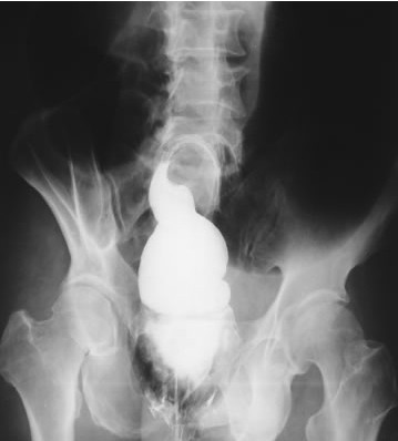 100张典型X线图片