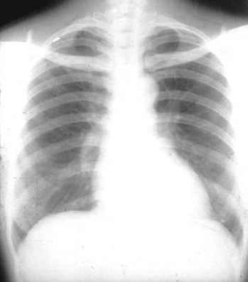 100张典型X线图片