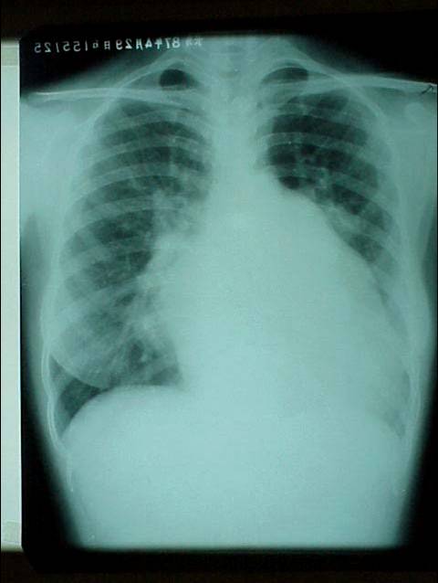 100张典型X线图片