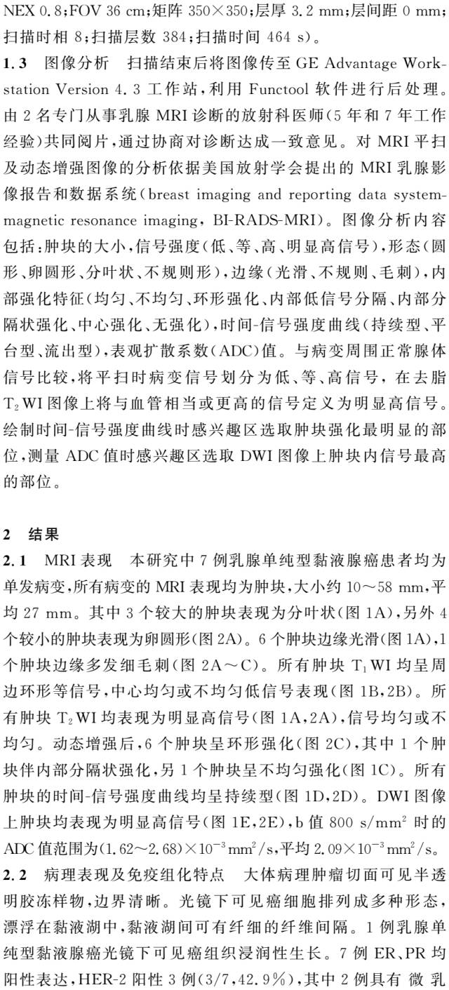 乳腺单纯型黏液腺癌的MRI表现 乳腺单纯型黏液腺癌的MRI表现