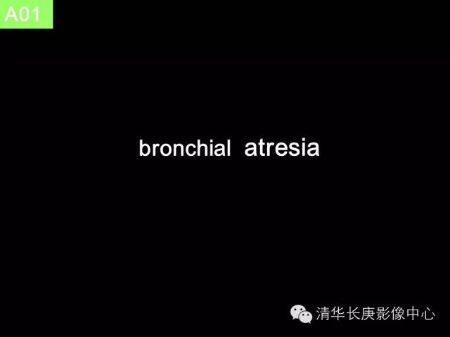 【病例】先天性支气管闭锁1例CT影像表现