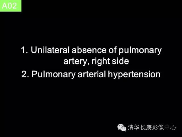 【病例】先天性单侧肺动脉缺如1例CT影像表现