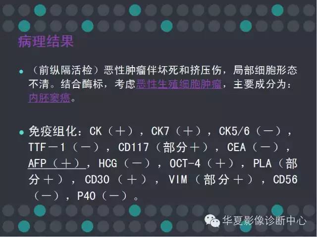 【病例】纵隔生殖细胞肿瘤1例CT影像表现