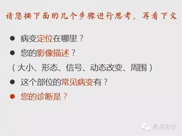 【病例】肺硬化性血管瘤1例CT影像表现与鉴别