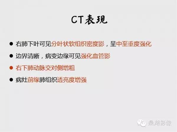 【病例】肺硬化性血管瘤1例CT影像表现与鉴别