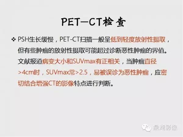 【病例】肺硬化性血管瘤1例CT影像表现与鉴别