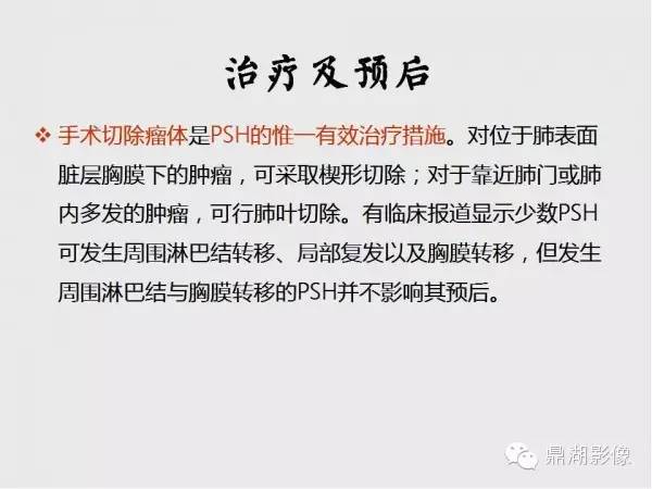 【病例】肺硬化性血管瘤1例CT影像表现与鉴别