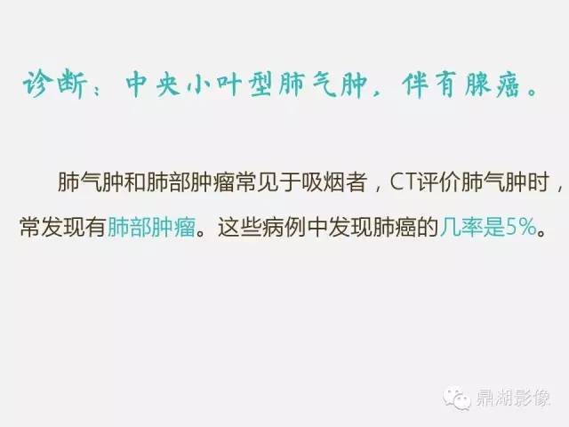 【PPT】肺内多发空洞和囊性病变诊断与鉴别诊断