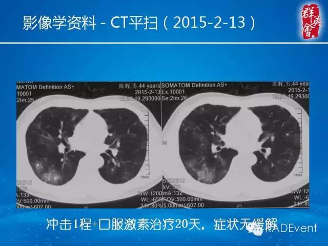【病例】毛霉菌肺炎1例CT影像表现