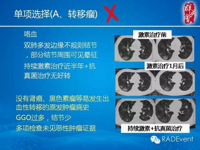 【病例】毛霉菌肺炎1例CT影像表现