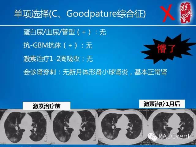 【病例】毛霉菌肺炎1例CT影像表现