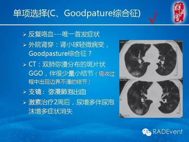 【病例】毛霉菌肺炎1例CT影像表现