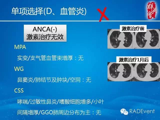 【病例】毛霉菌肺炎1例CT影像表现