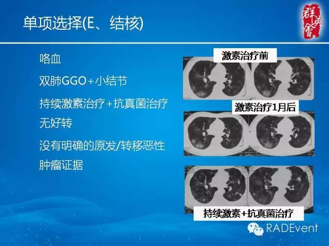 【病例】毛霉菌肺炎1例CT影像表现