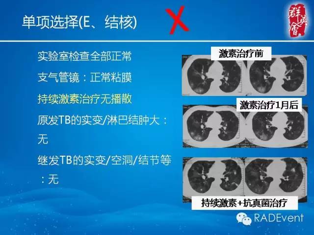 【病例】毛霉菌肺炎1例CT影像表现