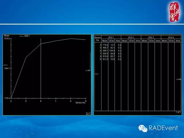 【病例】乳腺多发占位MR一例