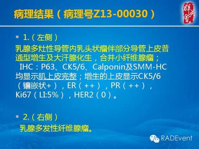 【病例】乳腺多发占位MR一例