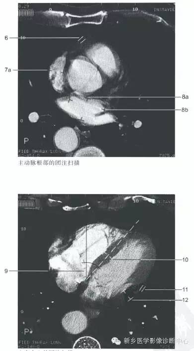 胸部的一些正常数值