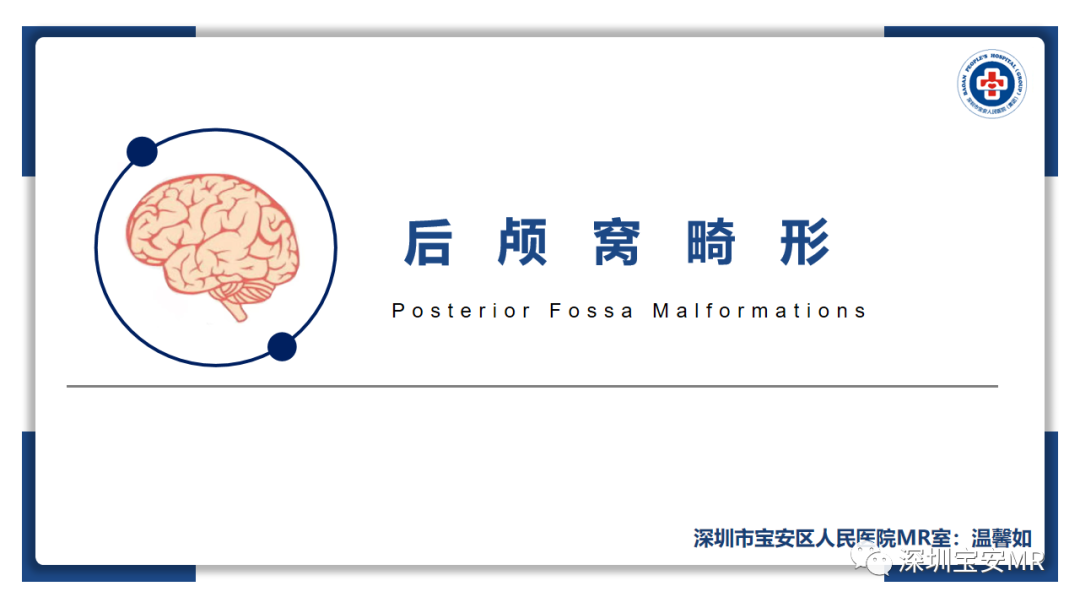 【PPT】后颅窝畸形