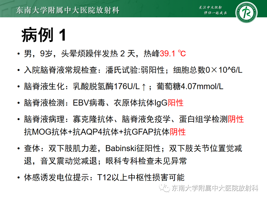 【PPT】皮层下U形纤维受累常见病变