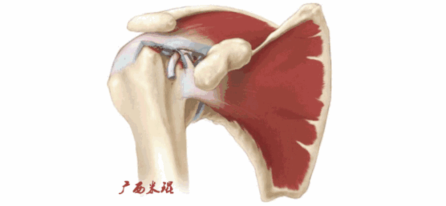 肩袖损伤的MRI诊断技巧