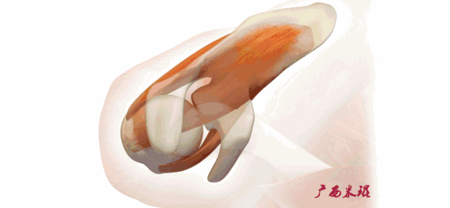 肩袖损伤的MRI诊断技巧