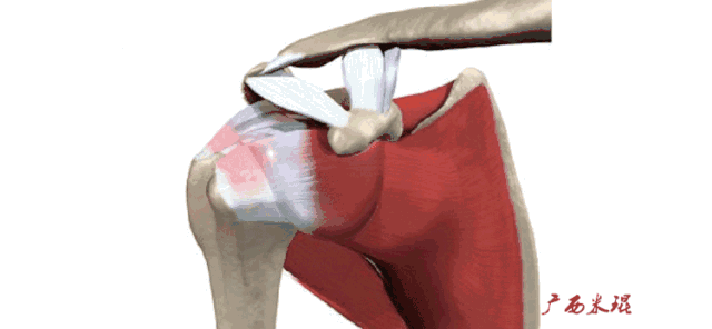 肩袖损伤的MRI诊断技巧
