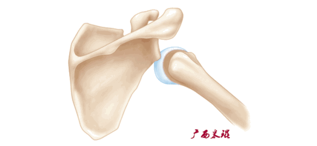 肩袖损伤的MRI诊断技巧