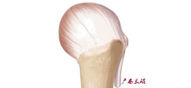 肩袖损伤的MRI诊断技巧