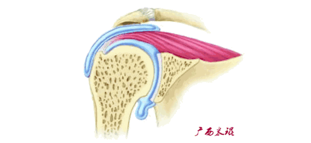 肩袖损伤的MRI诊断技巧