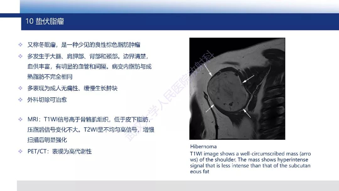 【PPT】含脂肪软组织肿瘤性病变影像诊断
