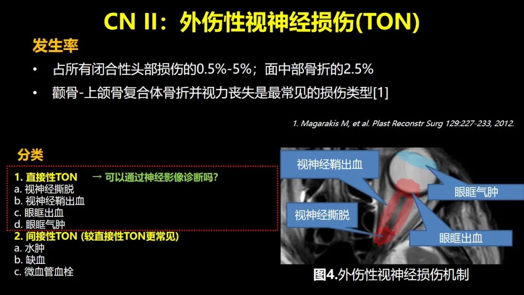 【PPT】创伤性颅神经损伤的影像表现-13