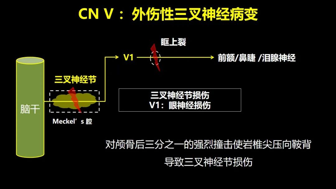 【PPT】创伤性颅神经损伤的影像表现-25