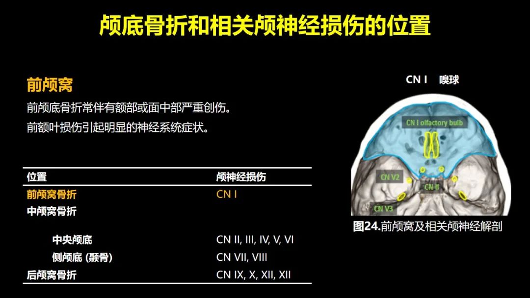 【PPT】创伤性颅神经损伤的影像表现-49