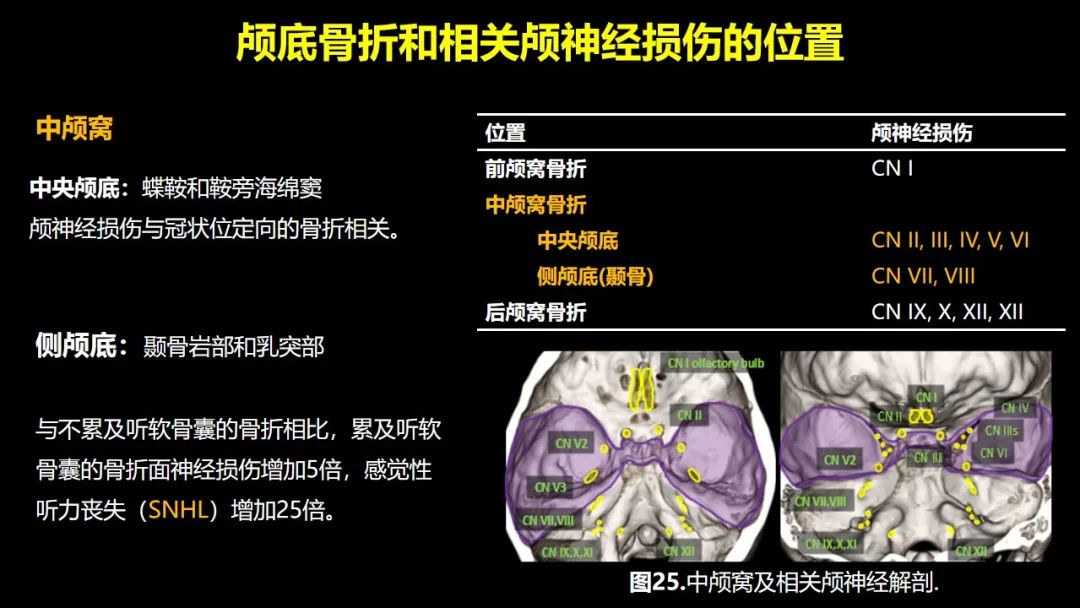 【PPT】创伤性颅神经损伤的影像表现-51