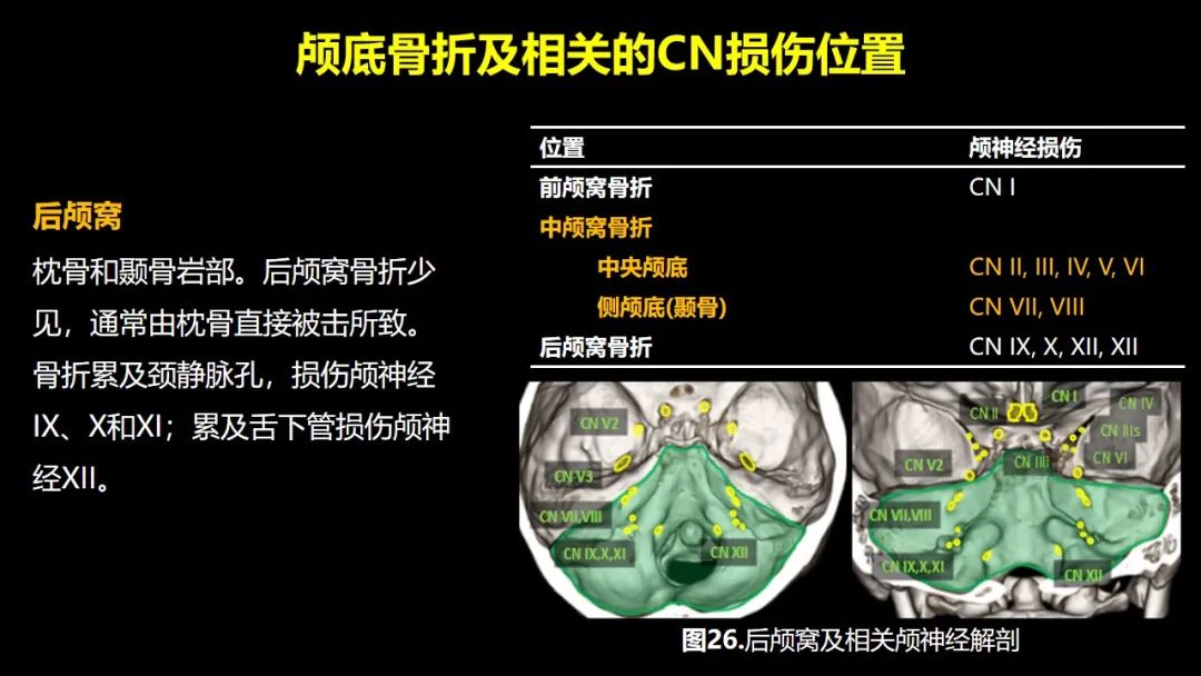 【PPT】创伤性颅神经损伤的影像表现-53