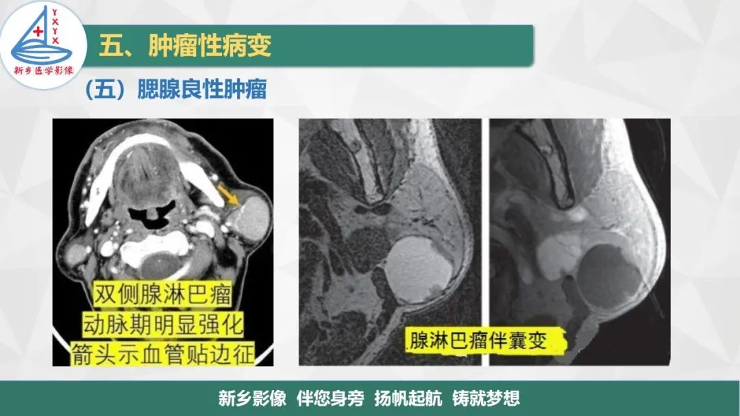 【PPT】医学影像诊断学教材解读—口腔颌面部疾病2-20