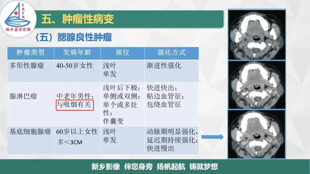 【PPT】医学影像诊断学教材解读—口腔颌面部疾病2-21