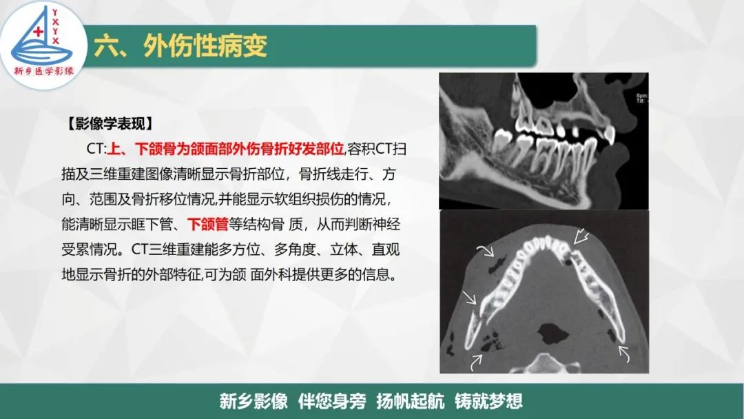 【PPT】医学影像诊断学教材解读—口腔颌面部疾病2-27