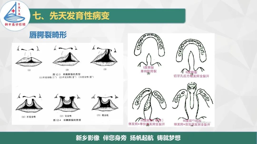 【PPT】医学影像诊断学教材解读—口腔颌面部疾病2-29