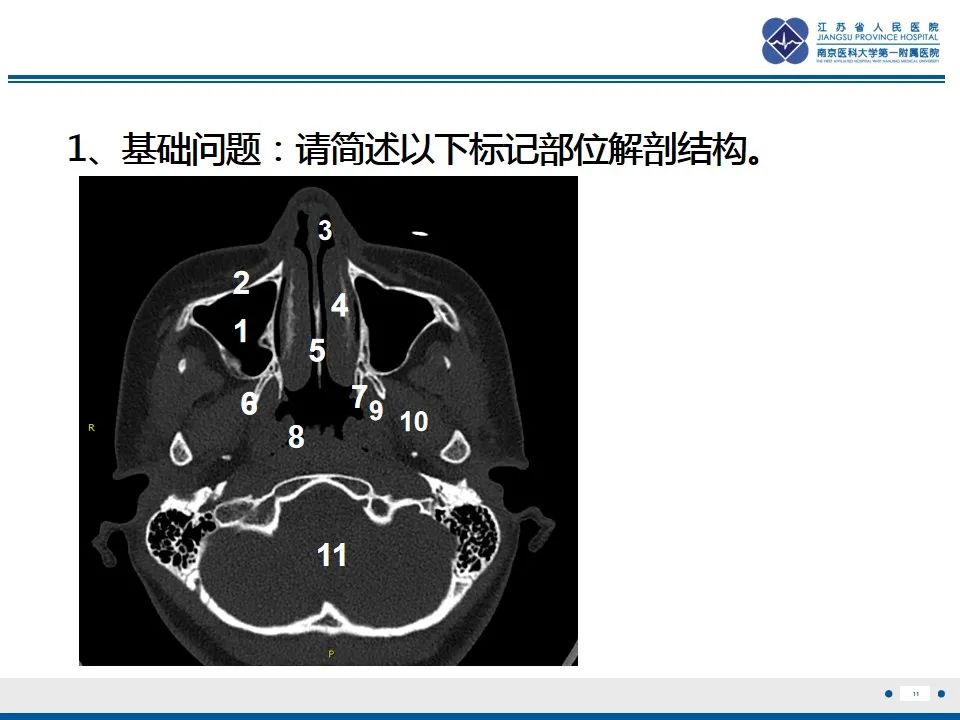 【PPT】鼻腔鼻窦鳞状细胞癌-12