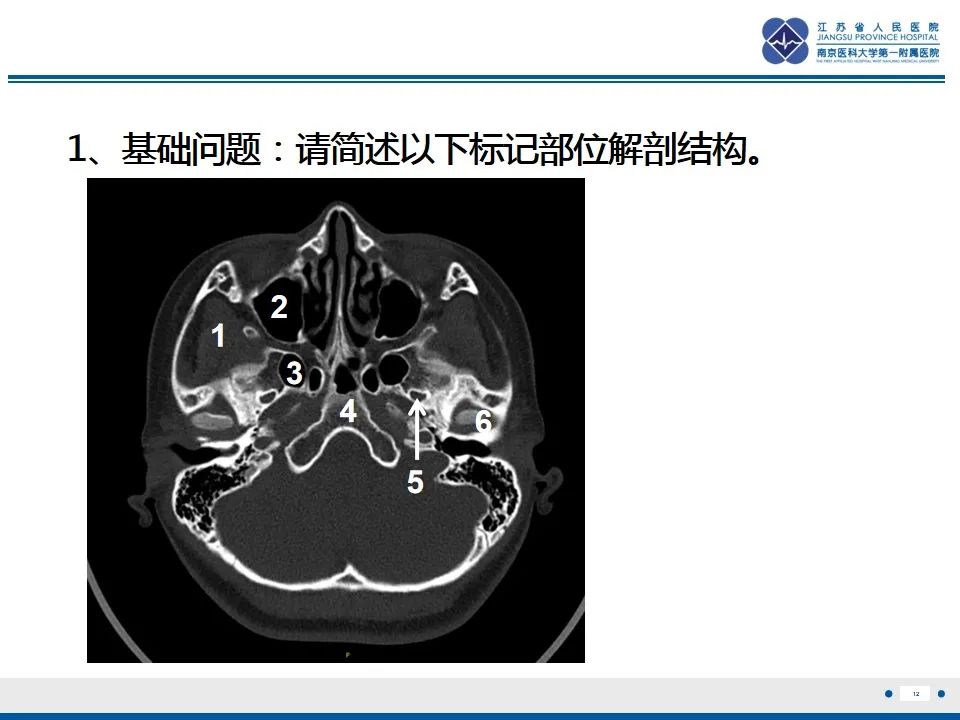 【PPT】鼻腔鼻窦鳞状细胞癌-13