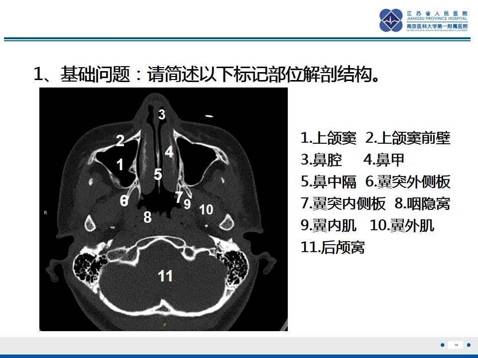 【PPT】鼻腔鼻窦鳞状细胞癌-15