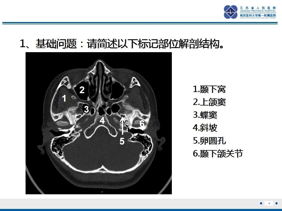 【PPT】鼻腔鼻窦鳞状细胞癌-16