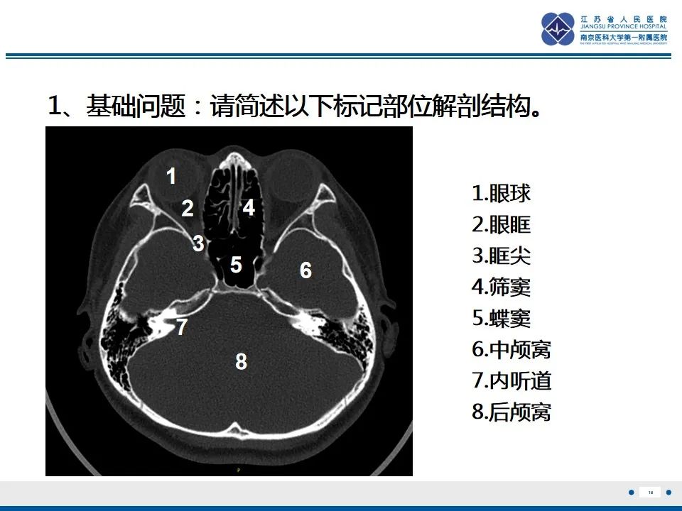 【PPT】鼻腔鼻窦鳞状细胞癌-17