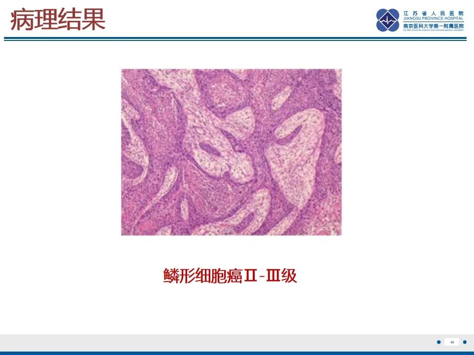 【PPT】鼻腔鼻窦鳞状细胞癌-23