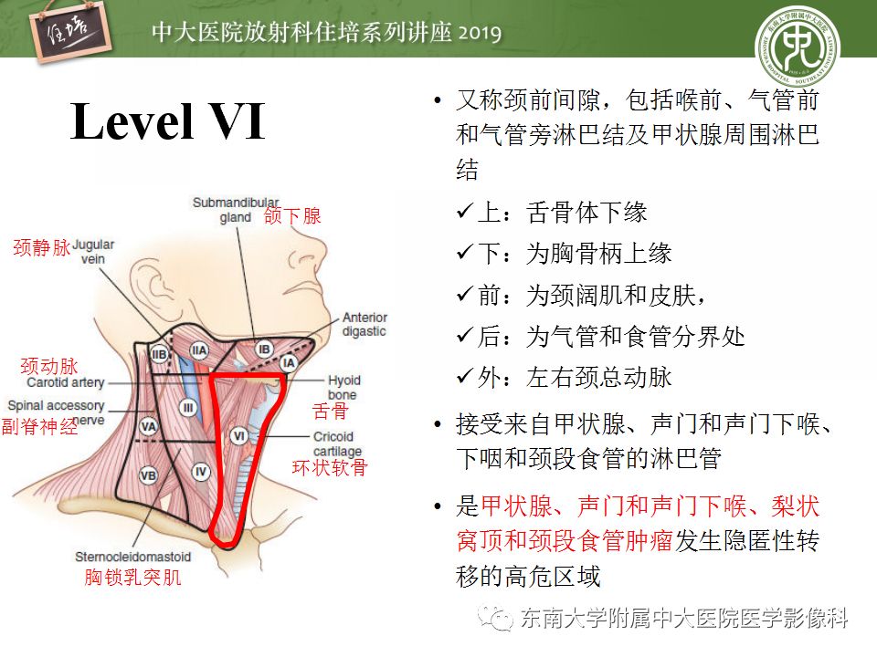 【PPT】颈部淋巴结的影像解剖及常见病变的影像表现-17