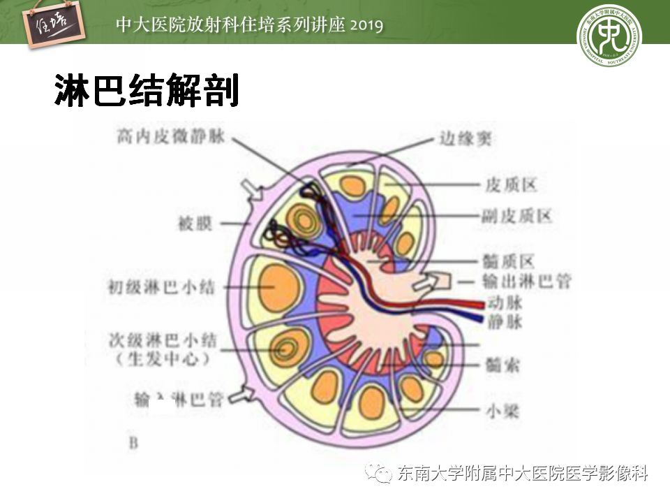 【PPT】颈部淋巴结的影像解剖及常见病变的影像表现-21