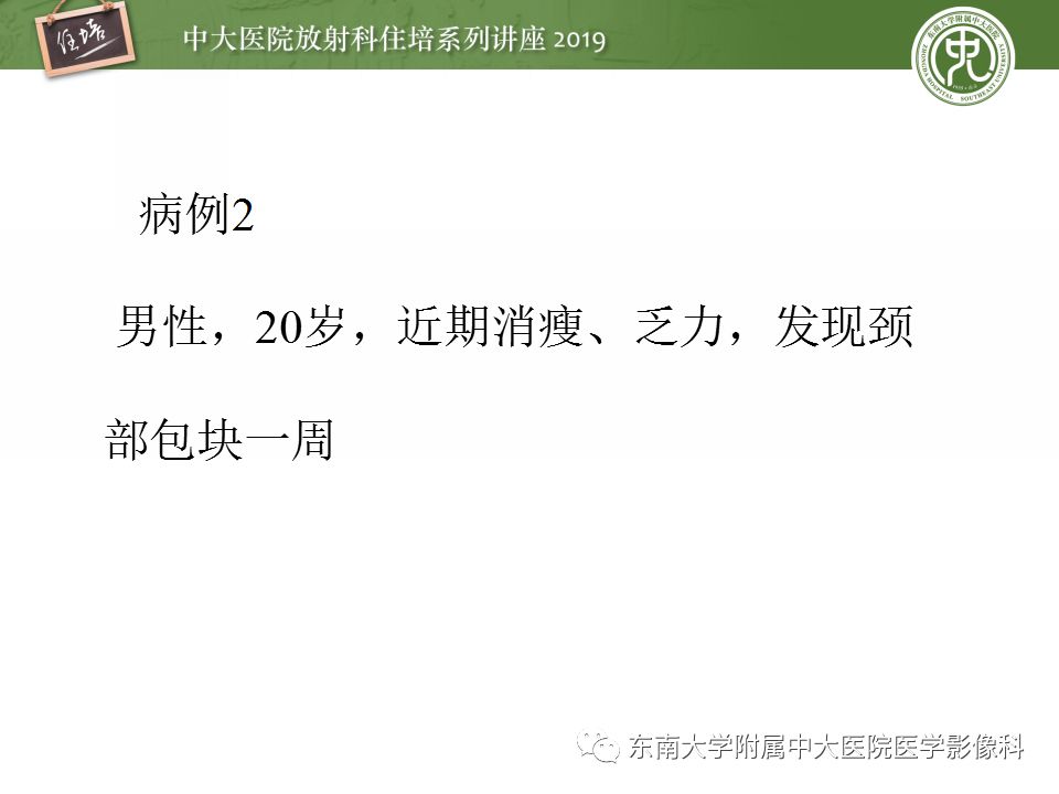 【PPT】颈部淋巴结的影像解剖及常见病变的影像表现-27